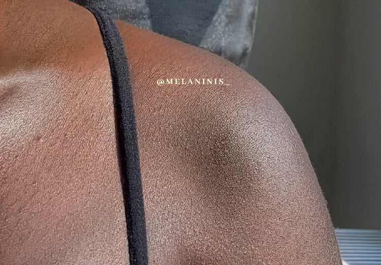 shoulder of skin before using the melanin is... product